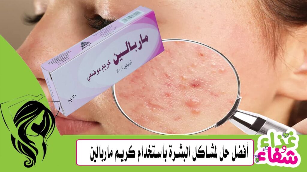 أفضل حل لمشاكل البشرة باستخدام كريم ماربالين