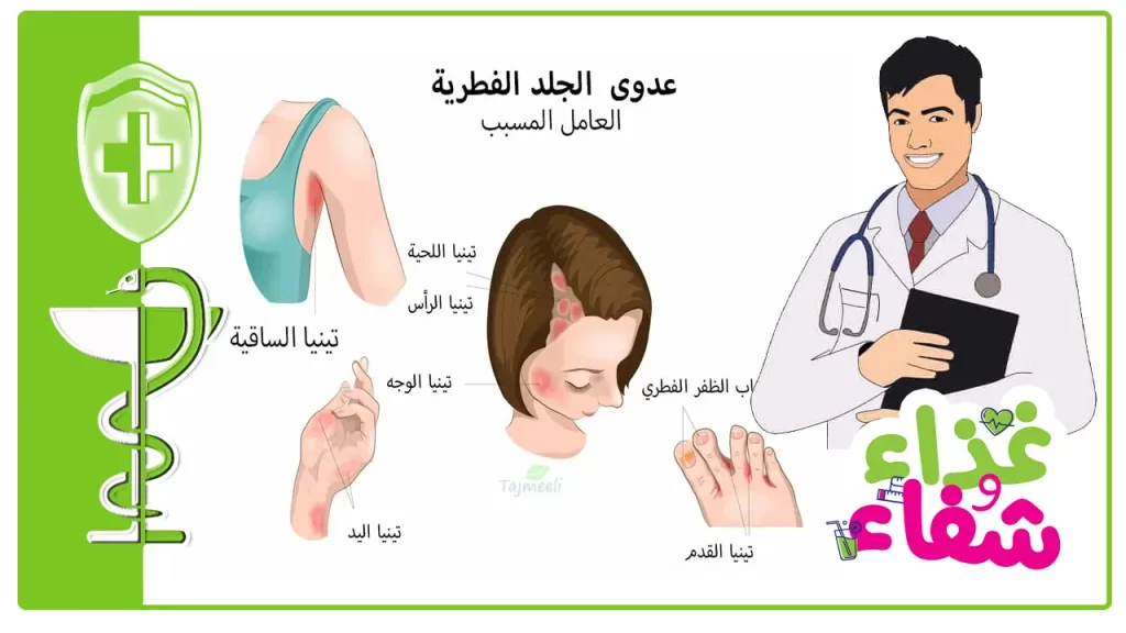 أسباب التهاب فروة الرأس